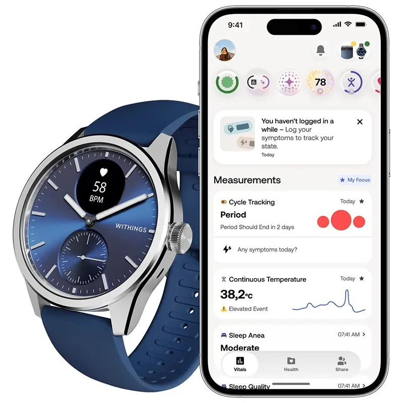 Withings ScanWatch Nova Brilliant Bl HWA10-MODEL 10-ALL